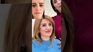 Möhtəşəm Dəyişim . Ceyrangöz . Gözaltı Işıq Dolğusu