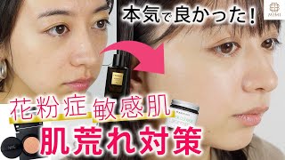 花粉症 これまでで一番よかった 敏感肌の花粉症 肌荒れ対策 井元まほ Mimitv Youtube 花粉症 これまでで一番よかった 敏感肌の花粉症 肌荒れ対策 井元まほ Mimitv Youtube