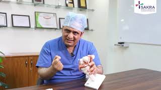 Meniscus Repair | Orthopedic Surgeon in Bangalore - Dr. Chandrashekar P | Sakra World Hospital screenshot 3