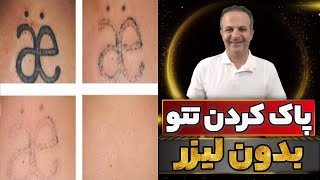 چگونه تاتو را پاک کنیم؟ | بهترین و سریع ترین روش پاک کردن تاتو ابرو و بدن در خانه (دکتر داوود)