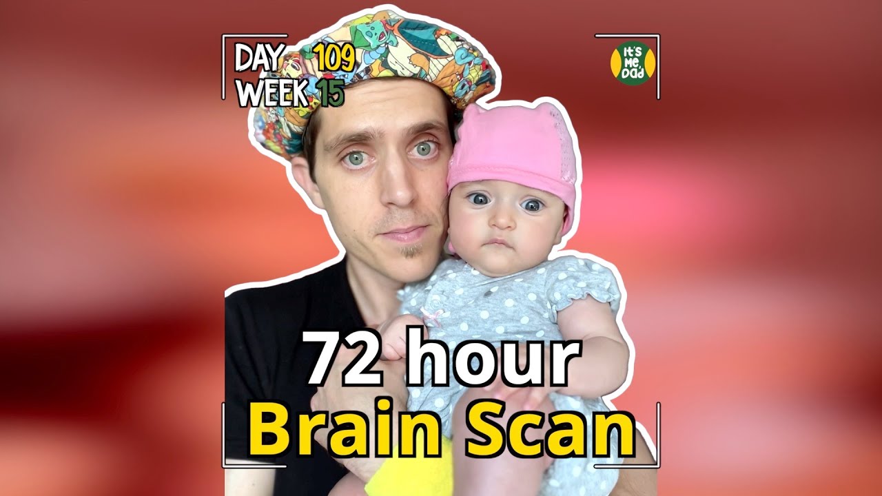 🧠 72 Hour Brain Scan  - #shorts