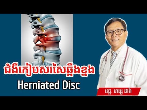 ជំងឺកៀបសរសៃឆ្អឹងខ្នង Herniated Disc | វេជ្ជបណ្ឌិត ហង្ស ដារ៉ា | ចំណេះដឹងសុខភាព | success knowledge