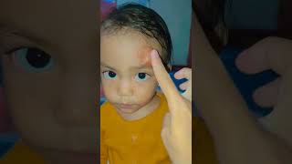 Download Lagu kepala benjol #shorts #solusi #funny #comedy #trending #subscribe MP3