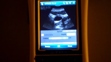 Ultrasound Demo on Trimble Windows Mobile 6 Rugged Handheld
