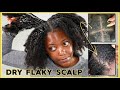 Get rid of Dry FLAKY SCALP on Natural Hair! Removing my Protective Style | KandidKinks