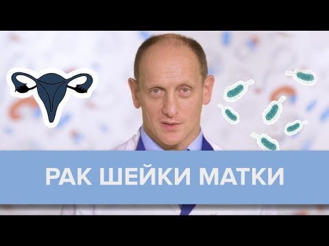 Что нужно знать о раке шейки матки? | Игорь Хатьков - Доктор 24