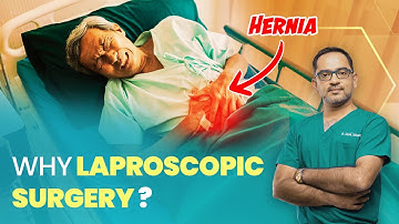 Laproscopic or Open Surgery for Hernia | Dr. Deepak Subramanian