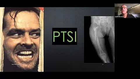 Dr. Sean Mulvaney talks about  The Breakthrough in...