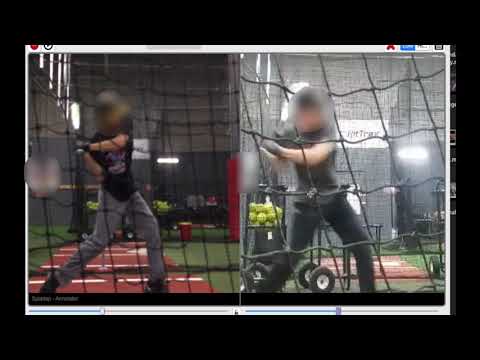 Fix Elbow Drag: 14 Days Later Before And After
