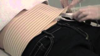 Laser Center MedSpa in Chicago, IL