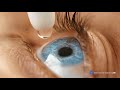 Are You a Victim of Nutrifill’s Contaminated Solution? | GetCompensation.Law (REVISED)