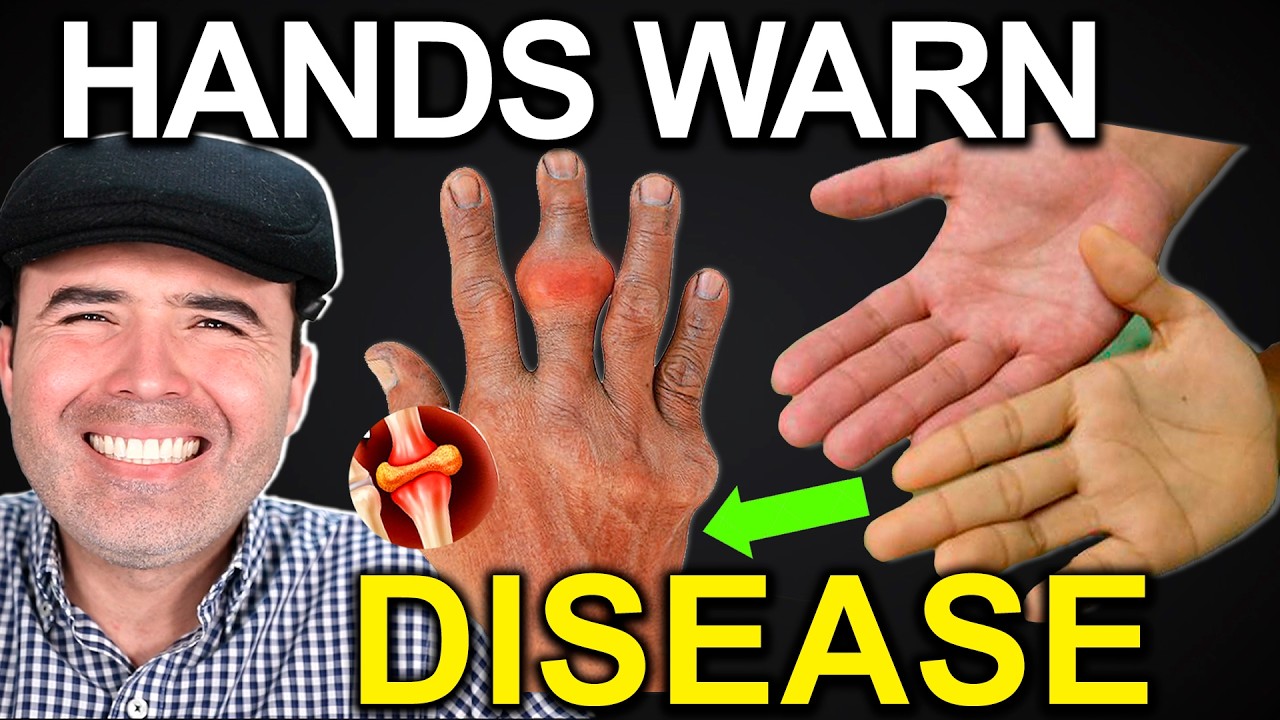 HAND ANALYSIS CAN SAVE YOU: 5 Symptoms Doctors Miss - DIY Health Check