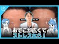 額が広くてストレスなら！ 私たちには額リフトがあります！ あなたの額ラインを完全に変えます！ オブジェ整形外科のシンジョンイン院長の額挙上