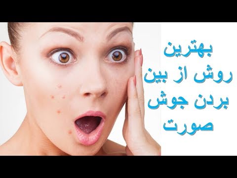 تصویری: مارون استوک رز ، زیبایی و شفا دهنده