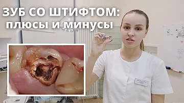 Зуб со штифтом: плюсы и минусы