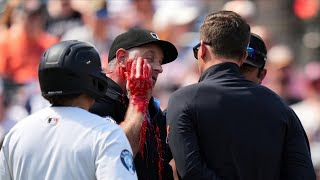 MLB• Worst Injuries 2026