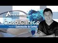 ►Caso Clínico: Cementación de Carillas | Dr. Jesús Dolores Flores