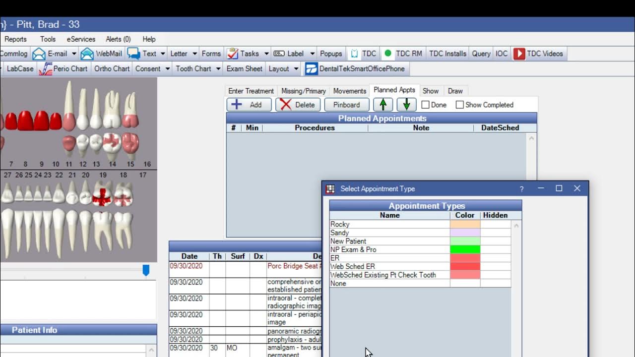 Open Dental Scheduling with Appointment Types YouTube