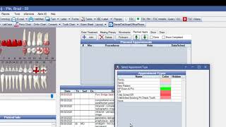 Open Dental Scheduling with Appointment Types