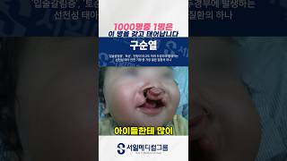 출생 시 1000명중 1명이 가지고 있는 안면기형