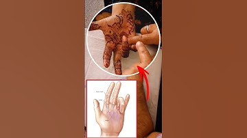 Finger Stuck? This Will SHOCK You! 😱🖐 #TriggerFinger