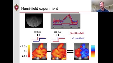 Functional MRI (fMRI) - 3: Temporal dynamics