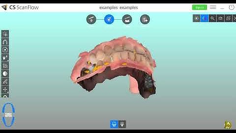 saving an implant scan correctly in CS ScanFlow