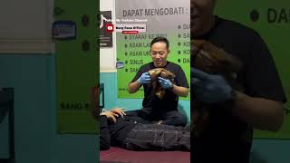 SAKIT LAMBUNG SUDAH 1 TAHUN || PENGOBATAN ALTERNATIF TOTOK SYARAF BANG RESA OFFICIAL