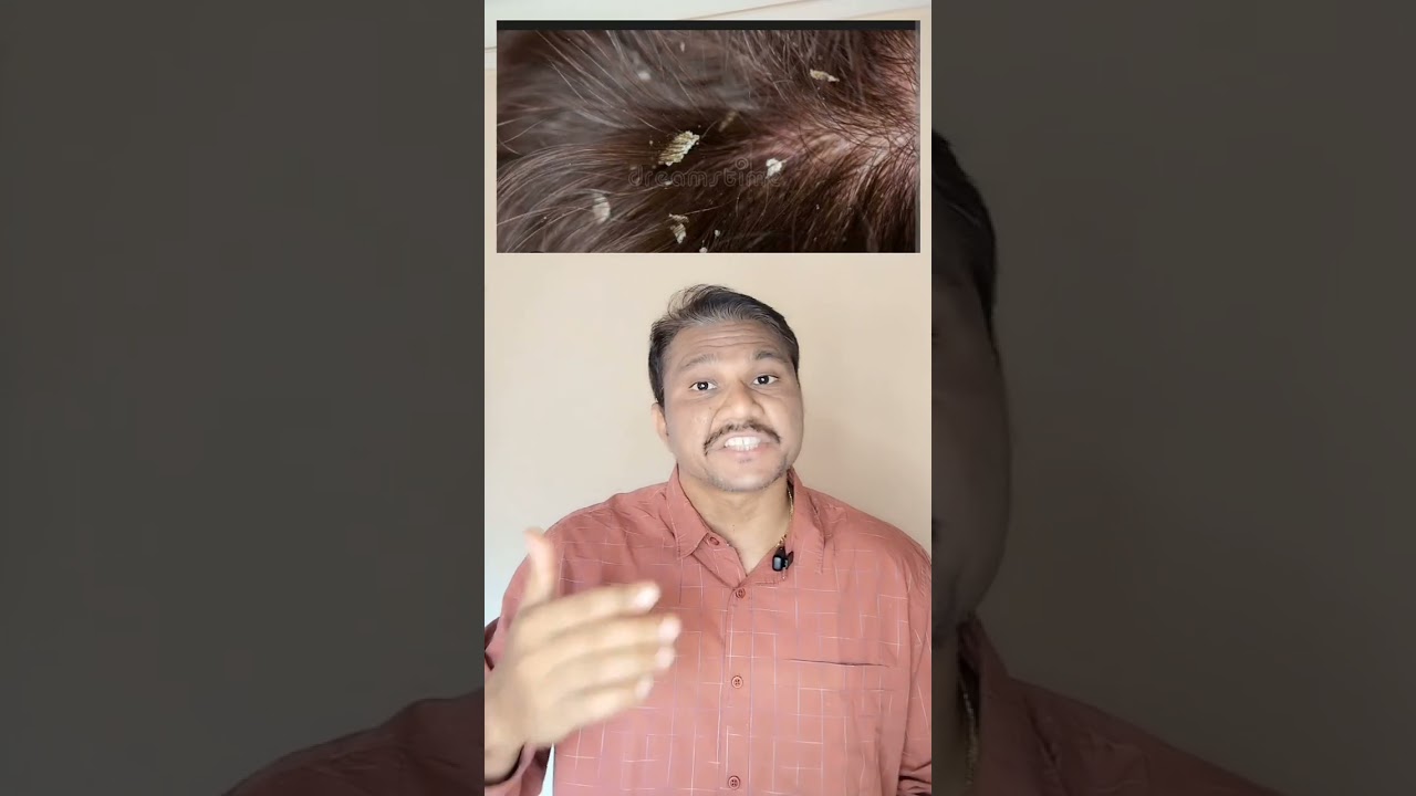 PharmEasy: Использование шампуня от перхоти с 2% кетоконазолом