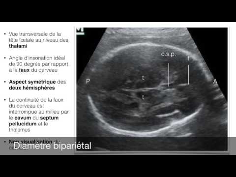 Vidéo: Comment mesurer la biométrie fœtale ?