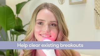 What is LightStim for Acne?