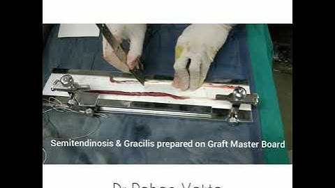 ACL (Anterior Cruciate Ligament) Graft Preparation Technique - Four Strands Hamstrings Tendon Graft