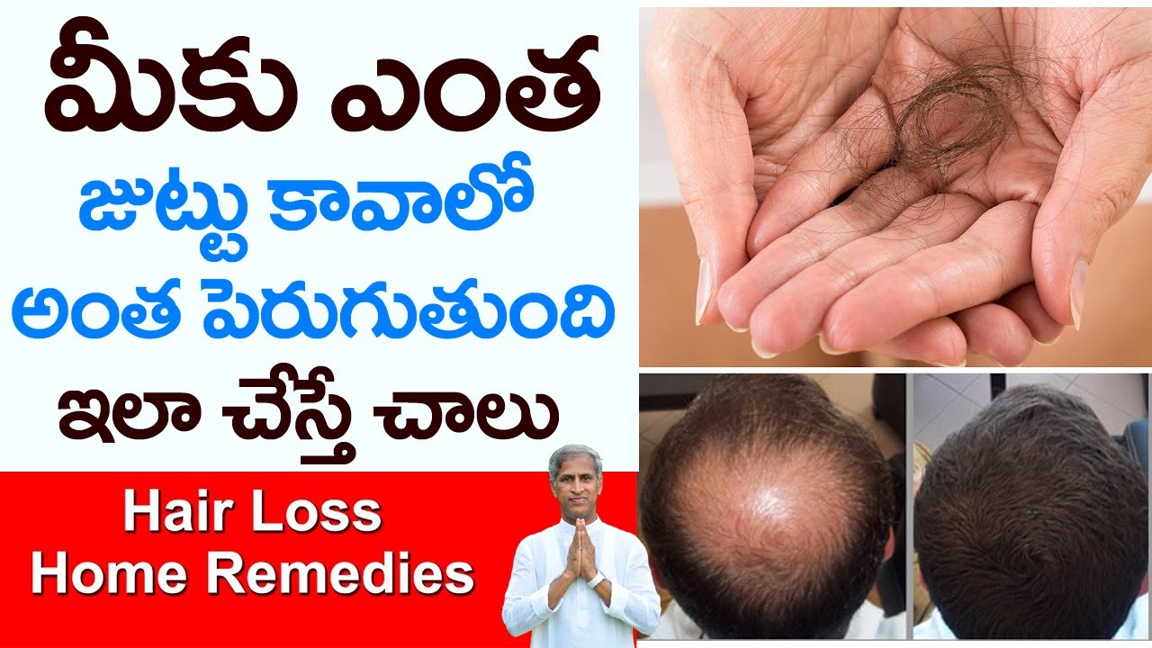 Hair fall problem  Homeopathy is the best solution  Dr Batras