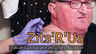 خراج صديدي عملاق شاهد Monster Cyst!