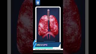 Are Hiccups Dangerous? ⚠️ | When to Worry &amp; What to DoHiccups#WhyHiccupsHappen#HealthAwareness#Mbbs