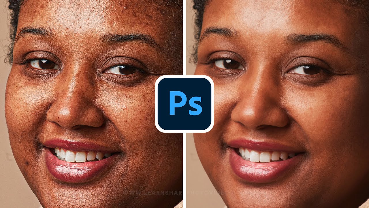 how-to-remove-pimples-from-face-in-photoshop-skin-retouching-photo