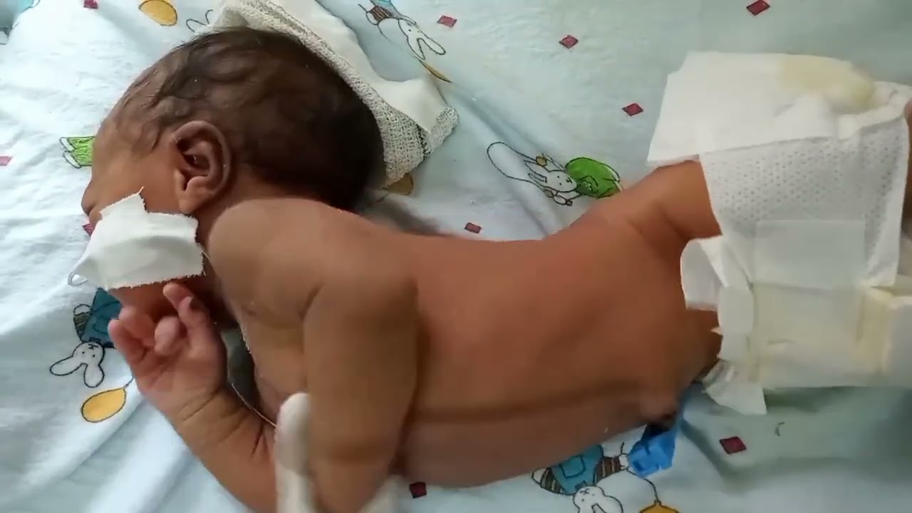 pediatrics physical exam clinical kernicterus video original