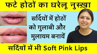 Home Remedy for Dry and Chapped Lips | Soft and Baby Pink Lips | Dr. Upasana Vohra screenshot 5