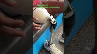 Rajasthan | Above Knee Prosthesis | OP4 Knee Joint | #ossur #naklipair #naklitang #artificiallimb