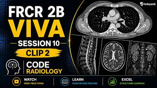 Code Radiology Session 10 Clip 2 - Radiology FRCR 2B Mock Viva and Radiology Interesting Cases
