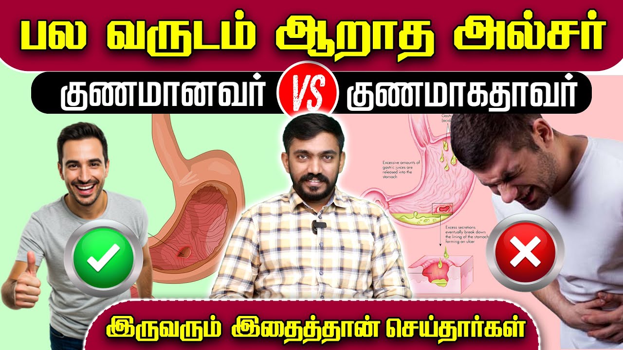எவ்வளவு செலவு செய்தும் குணமாகாத அல்சர் எப்படி குணமானது How to cure ulcer