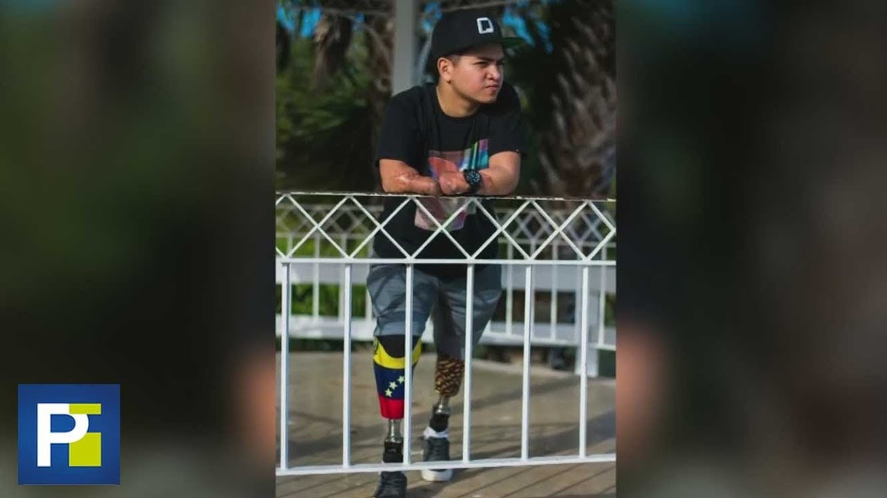Perdió las piernas de niño durante unas vacaciones en EEUU, pero con su fortaleza salió adelante video phone beyonce mp3