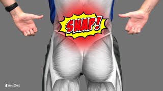 How to Fix Lower Back POPPING Sounds at Home