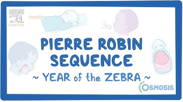 Pierre Robin Sequence (Year of the Zebra)