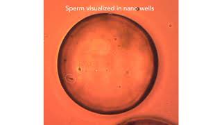 Shilps Sciences Video For Wrms Webinar 1