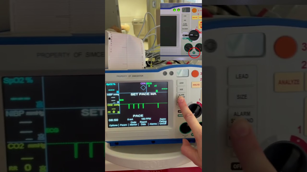 Pacer Check for Zoll R Series Defibrillator - YouTube
