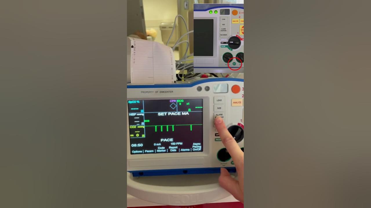 Pacer Check for Zoll R Series Defibrillator YouTube