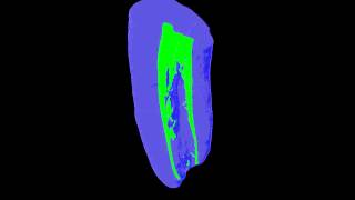 Single File Preparation Sample 6