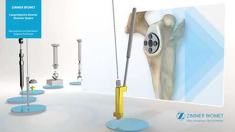 Comprehensive Reverse Shoulder System Surgical Technique Animation