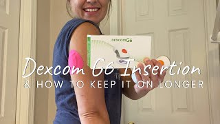Dexcom G6 Insertion & How To Keep It On Longer